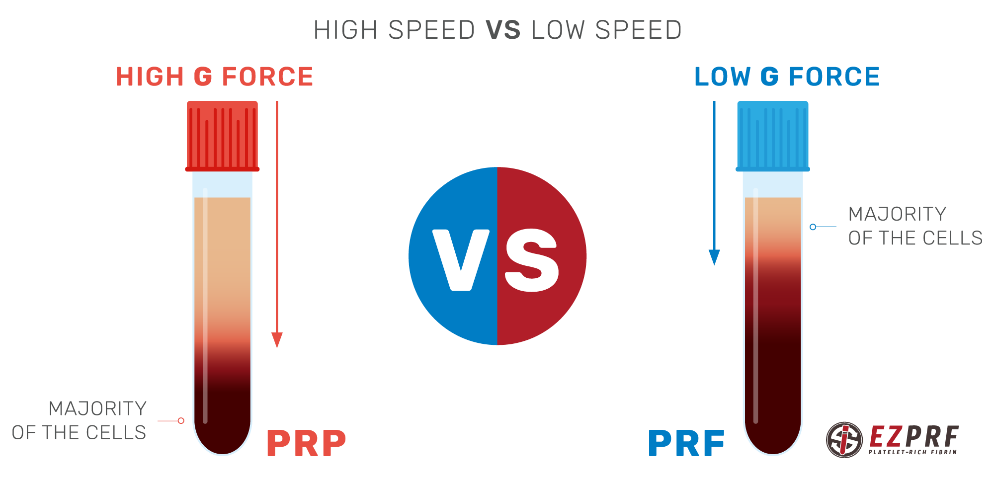 Prp Vs Prf